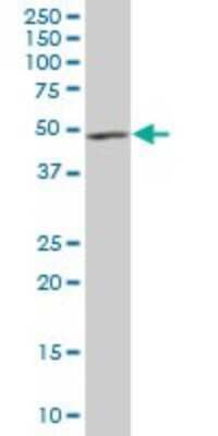 Western Blot: Dynactin Subunit 2/DCTN2/DCTN-50 Antibody [H00010540-B01P] - Analysis of DCTN2 expression in human spleen.