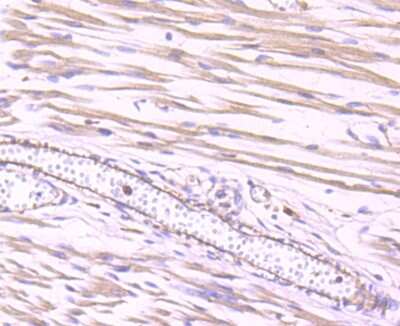 Immunohistochemistry-Paraffin: Dynamin 2 Antibody (JM61-38) [NBP2-66813] - Analysis of paraffin-embedded human fetal skeletal muscle tissue using anti-Dynamin 2 antibody. Counter stained with hematoxylin.