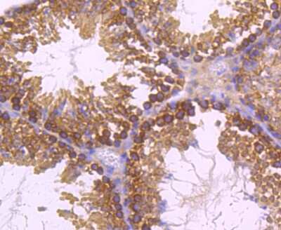 Immunohistochemistry-Paraffin: Dynamin 2 Antibody (JM61-38) [NBP2-66813] - Analysis of paraffin-embedded mouse testes tissue using anti-Dynamin 2 antibody. Counter stained with hematoxylin.