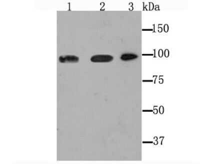 Western Blot: Dynamin 2 Antibody (JM61-38) [NBP2-66813] - Analysis of Dynamin 2 on different lysates using anti-Dynamin 2 antibody at 1/1,000 dilution.Positive control:Lane1: PC-12Lane2: Mouse thymusLane3: Hela