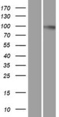 Western Blot: Dynamin 2 Overexpression Lysate (Adult Normal) [NBP2-10512] Left-Empty vector transfected control cell lysate (HEK293 cell lysate); Right -Over-expression Lysate for Dynamin 2.