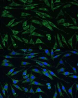 Immunocytochemistry/Immunofluorescence: Dynamin 3 Antibody [NBP2-92627] - Analysis of L929 cells using Dynamin 3 . Blue: DAPI for nuclear staining.
