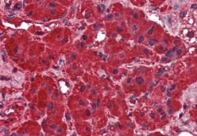Immunohistochemistry-Paraffin: Dynamin 3 Antibody [NB100-93449] - (2.5ug/ml) staining of paraffin embedded Human Adrenal Gland. Steamed antigen retrieval with citrate buffer pH 6, AP-staining.