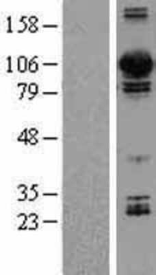 Western Blot: Dynamin 3 Overexpression Lysate (Adult Normal) [NBL1-09969] Left-Empty vector transfected control cell lysate (HEK293 cell lysate); Right -Over-expression Lysate for Dynamin 3.