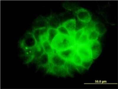 Immunocytochemistry/Immunofluorescence: Dynein intermediate chain 2 Antibody (1C8) [H00064446-M01] - Analysis of monoclonal antibody to DNAI2 on A-431 cell. Antibody concentration 10 ug/ml.