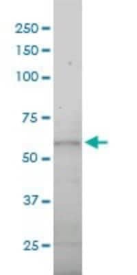 Western Blot: Dynein intermediate chain 2 Antibody (1C8) [H00064446-M01] - DNAI2 monoclonal antibody (M01), clone 1C8 Analysis of DNAI2 expression in A-431.