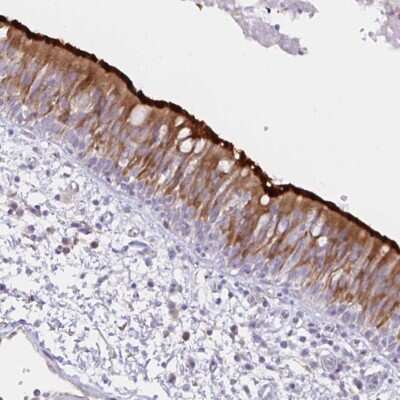Immunohistochemistry-Paraffin: Dynein intermediate chain 2 Antibody [NBP2-37927] - Staining of human bronchus shows moderate to strong membranous positivity in respiratory epithelial cells.