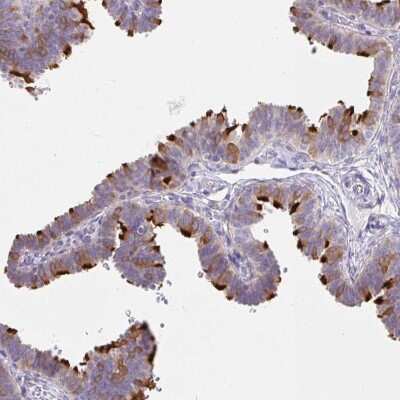 Immunohistochemistry-Paraffin: Dynein intermediate chain 2 Antibody [NBP2-37927] - Staining of human fallopian tube shows strong cytoplasmic positivity in glandular cells.