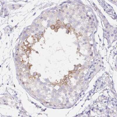 Immunohistochemistry-Paraffin: Dynein intermediate chain 2 Antibody [NBP2-37927] - Staining of human testis shows moderate to strong cytoplasmic positivity in cells in seminiferous ducts.