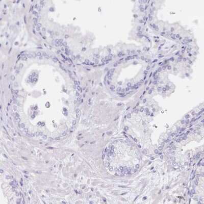 Immunohistochemistry-Paraffin: Dynein intermediate chain 2 Antibody [NBP2-37927] - Staining of human prostate shows no positivity in glandular cells as expected.