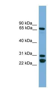 Western Blot: Dynein intermediate chain 2 Antibody [NBP1-80509] - PANC1 cell lysate, concentration 0.2-1 ug/ml.