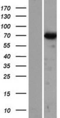 Western Blot Dynein intermediate chain 2 Overexpression Lysate