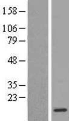 Western Blot: Dynein light chain 4 Overexpression Lysate (Adult Normal) [NBL1-09958] Left-Empty vector transfected control cell lysate (HEK293 cell lysate); Right -Over-expression Lysate for Dynein light chain 4.