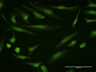 Immunocytochemistry/Immunofluorescence: Dyrk1B Antibody (2E8) [H00009149-M10] - Analysis of monoclonal antibody to DYRK1B on HeLa cell. Antibody concentration 10 ug/ml