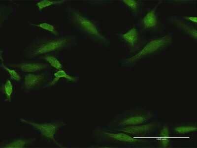 Immunocytochemistry/Immunofluorescence: Dyrk1B Antibody [H00009149-D01P] - Analysis of antibody to DYRK1B on HeLa cell. Antibody concentration 10 ug/ml.