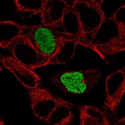 Immunocytochemistry/Immunofluorescence: Dyrk1B Antibody [NBP2-55096] - Staining of human cell line SH-SY5Y shows localization to nucleus.