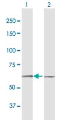 Western Blot: Dyrk1B Antibody [H00009149-B01P] - Analysis of DYRK1B expression in transfected 293T cell line by DYRK1B polyclonal antibody.  Lane 1: DYRK1B transfected lysate(69.19 KDa). Lane 2: Non-transfected lysate.