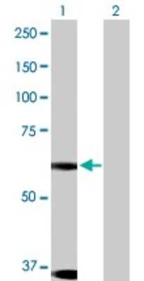 Western Blot Dyrk1B Antibody