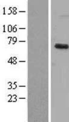 Western Blot Dyrk1B Overexpression Lysate