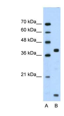 Western Blot: Dysadherin Antibody [NBP1-59137] - Titration: 1.25ug/ml Positive Control: Jurkat cell lysate.