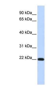 Western Blot: Dysadherin Antibody [NBP1-59138] - Titration: 0.2-1 ug/ml, Positive Control: Human heart.