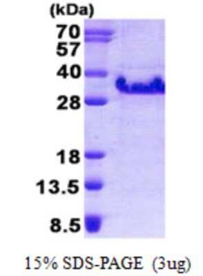 SDS-Page: Recombinant Human FXYD5/Dysadherin Protein [NBP2-23064]