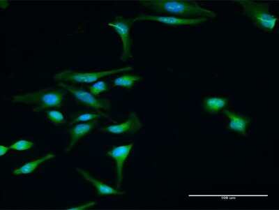 Immunocytochemistry/Immunofluorescence: Dysbindin Antibody [H00084062-D01P] - Analysis of antibody to DTNBP1 on HeLa cell. Antibody concentration 30 ug/ml.