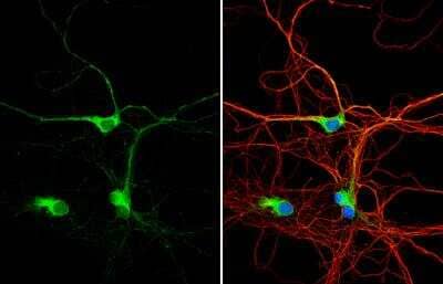 Immunocytochemistry/Immunofluorescence: Dysbindin Antibody [NBP2-16245] - DIV9 rat E18 primary hippocampal neuron cells were fixed in 4% paraformaldehyde at RT for 15 min. Green: Dysbindin stained by Dysbindin antibody diluted at 1:500.Red: beta Tubulin 3/ Tuj1, stained by beta Tubulin 3/ Tuj1 antibody [11710] diluted at 1:500. Blue: Fluoroshield with DAPI.