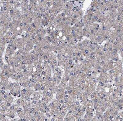 Immunohistochemistry-Paraffin: Dysbindin Antibody [NBP1-85299] - Staining of human liver shows negative positivity in hepatocytes as expected.