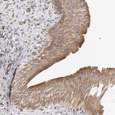 Immunohistochemistry-Paraffin: Dysbindin Antibody [NBP1-85300] - Staining of human urinary bladder shows moderate cytoplasmic and luminal membrane positivity in urothelial cells.