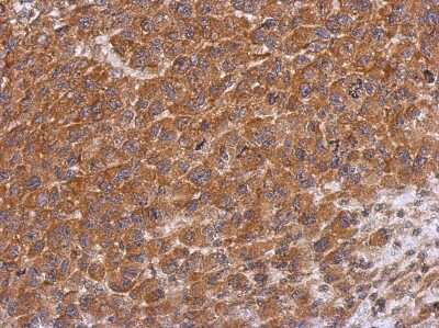 Immunohistochemistry-Paraffin: Dysbindin Antibody [NBP2-16245] - Immunohistochemical analysis of paraffin-embedded H1299 xenograft, using antibody at 1:500 dilution.