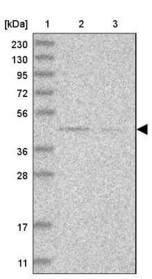 Western Blot: Dysbindin Antibody [NBP1-85299] - Lane 1: Marker  [kDa] 230, 130, 95, 72, 56, 36, 28, 17, 11.  Lane 2: Human cell line RT-4.  Lane 3: Human cell line U-251MG sp