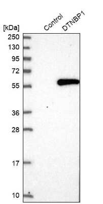 Western Blot: Dysbindin Antibody [NBP1-85300] - Analysis in control (vector only transfected HEK293T lysate) and DTNBP1 over-expression lysate (Co-expressed with a C-terminal myc-DDK tag (3.1 kDa) in mammalian HEK293T cells).