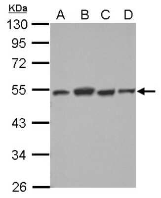 Western Blot: Dysbindin Antibody [NBP2-16245] - Sample (30 ug of whole cell lysate) A: NT2D1 B: PC-3 C: U87-MG D: SK-N-SH 10% SDS PAGE gel, diluted at 1:2000.