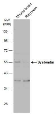 Western Blot: Dysbindin Antibody [NBP2-16245] - Various tissue extracts (50 ug) were separated by 10% SDS-PAGE, and the membrane was blotted with Dysbindin antibody diluted at 1:500. The HRP-conjugated anti-rabbit IgG antibody (NBP2-19301) was used to detect the primary antibody, and the signal was developed with Trident ECL plus-Enhanced.