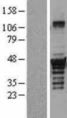 Western Blot: Dysbindin Overexpression Lysate (Adult Normal) [NBL1-10034] Left-Empty vector transfected control cell lysate (HEK293 cell lysate); Right -Over-expression Lysate for Dysbindin.