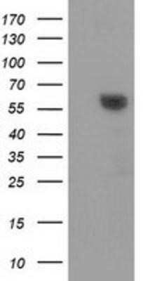 Western Blot: Dystrobrevin alpha Antibody (OTI1B2) - Azide and BSA Free [NBP2-70591] - HEK293T cells were transfected with the pCMV6-ENTRY control (Left lane) or pCMV6-ENTRY Dystrobrevin alpha (Right lane) cDNA for 48 hrs and lysed. Equivalent amounts of cell lysates (5 ug per lane) were separated by SDS-PAGE and immunoblotted with anti-Dys