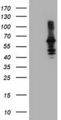 Western Blot: Dystrobrevin beta Antibody (3A12) [NBP2-01798] - HEK293T cells were transfected with the pCMV6-ENTRY control (Left lane) or pCMV6-ENTRY Dystrobrevin beta (Right lane) cDNA for 48 hrs and lysed. Equivalent amounts of cell lysates (5 ug per lane) were separated by SDS-PAGE and immunoblotted with anti-Dystrobrevin beta.