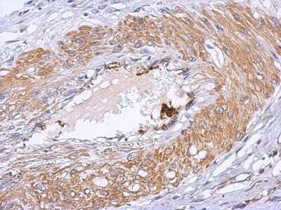 Immunohistochemistry-Paraffin Dystrobrevin beta Antibody