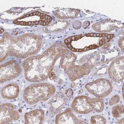 Immunohistochemistry-Paraffin Dystrobrevin beta Antibody - BSA Free