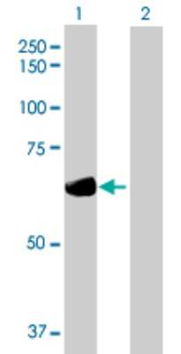Western Blot: Dystrobrevin beta Antibody [H00001838-B01P] - Analysis of DTNB expression in transfected 293T cell line by DTNB polyclonal antibody.  Lane 1: DTNB transfected lysate(66.99 KDa). Lane 2: Non-transfected lysate.