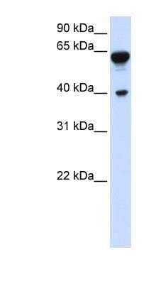 Western Blot: Dystrobrevin beta Antibody [NBP1-56492] - Transfected 293T cell lysate, concentration 0.2-1 ug/ml.