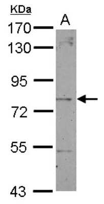 Western Blot Dystrobrevin beta Antibody