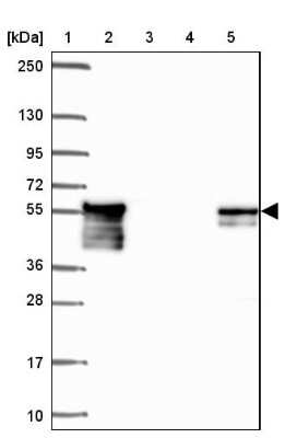 Western Blot Dystrobrevin beta Antibody - BSA Free