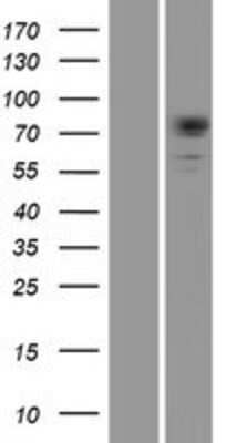 Western Blot: Dystrophia myotonica protein kinase Overexpression Lysate (Adult Normal) [NBP2-10590] Left-Empty vector transfected control cell lysate (HEK293 cell lysate); Right -Over-expression Lysate for Dystrophia myotonica protein kinase.