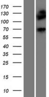 Western Blot: Dystrophia myotonica protein kinase Overexpression Lysate (Adult Normal) [NBP2-10661] Left-Empty vector transfected control cell lysate (HEK293 cell lysate); Right -Over-expression Lysate for Dystrophia myotonica protein kinase.