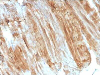 Immunohistochemistry-Paraffin: Dystrophin Antibody (DMD/3243) [NBP3-08665] - Formalin-fixed, paraffin-embedded human Skeletal Muscle stained with Dystrophin Monospecific Mouse Monoclonal Antibody (DMD/3243).