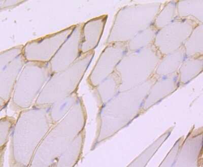 Immunohistochemistry-Paraffin: Dystrophin Antibody (JF1-022) [NBP2-66815] - Analysis of paraffin-embedded mouse skeletal muscle tissue using anti-Dystrophin antibody. Counter stained with hematoxylin.