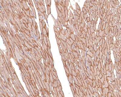 Immunohistochemistry-Paraffin: Dystrophin Antibody (JF1-022) [NBP2-66815] - Analysis of paraffin-embedded rat heart tissue with Rabbit anti-Dystrophin antibody washed with ddH2O and PBS, and then probed with the primary antibody  at 1/400 dilution for 1 hour at room temperature. The detection was performed using an HRP conjugated compact polymer system. DAB was used as the chromogen. Tissues were counterstained with hematoxylin and mounted with DPX.