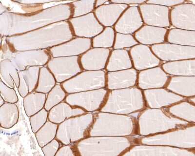 Immunohistochemistry-Paraffin: Dystrophin Antibody (JF1-022) [NBP2-66815] - Analysis of paraffin-embedded human striated muscle tissue with Rabbit anti-Dystrophin antibody washed with ddH2O and PBS, and then probed with the primary antibody  at 1/400 dilution for 1 hour at room temperature. The detection was performed using an HRP conjugated compact polymer system. DAB was used as the chromogen. Tissues were counterstained with hematoxylin and mounted with DPX.